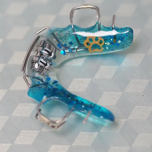 aparat ortodontyczny dla dziecka